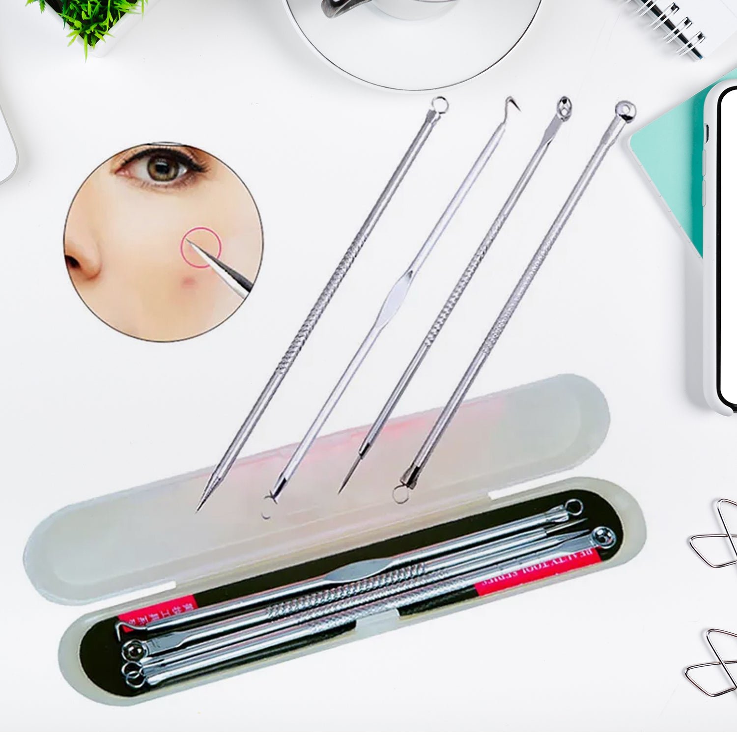 Blackhead Remover, 4-in-1 Stainless Steel Pimple Extractor Tool (1 Pc) - Image 2
