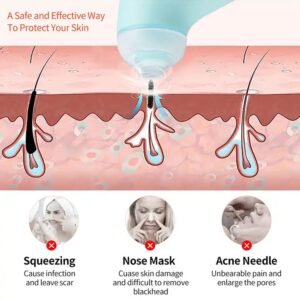 Mini Handheld Vacuum Blackhead Remover – Facial Massage & Spot Lifting (1 Pc)